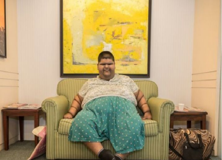 creating-miracles-worlds-heaviest-teen-237-kg-received-bariatric-treatment