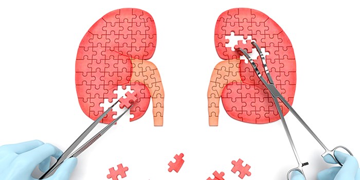 kidney-transplantation-steps-to-follow