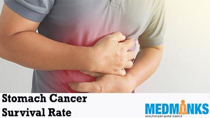 taxa de sobrevivência de câncer de estômago na Índia