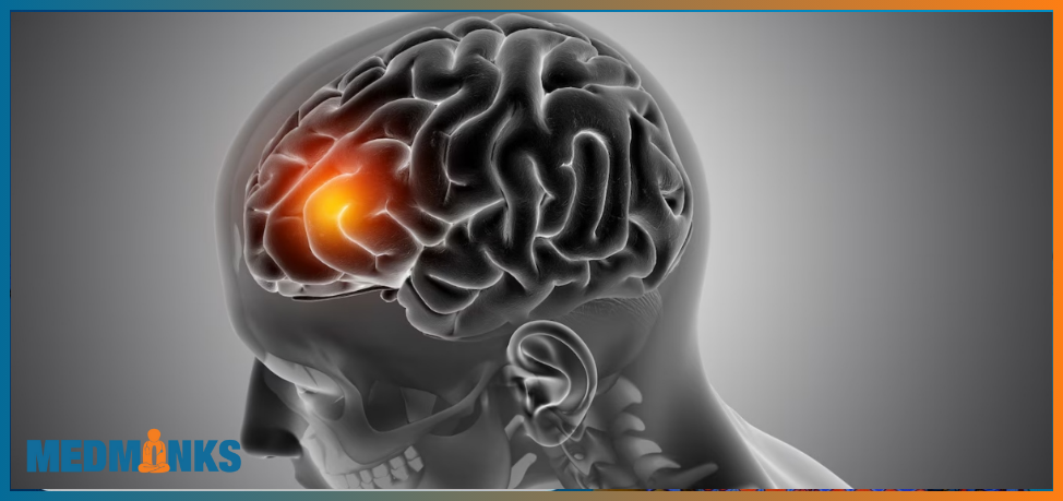 4-successful-ways-to-treat-brain-tumors