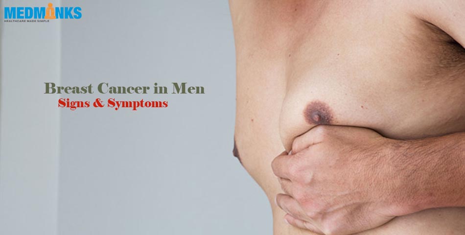 рак груди мужчины
