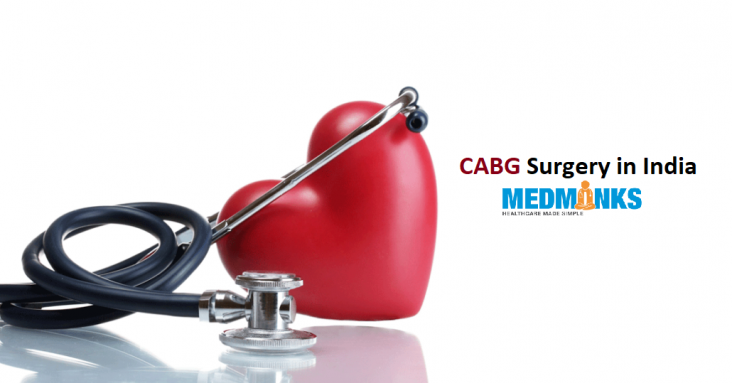 cabg-surgery-india-low-cost-best-hospitals