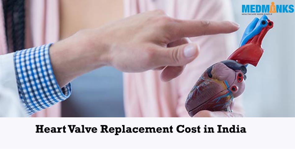 сердечный клапан-замена-стоимость-Индия