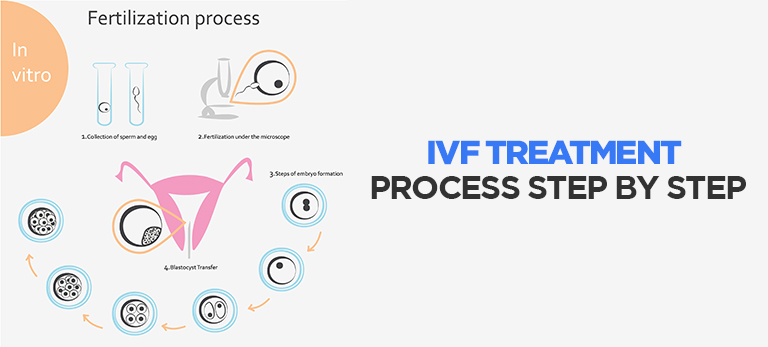 processus de FIV étape par étape