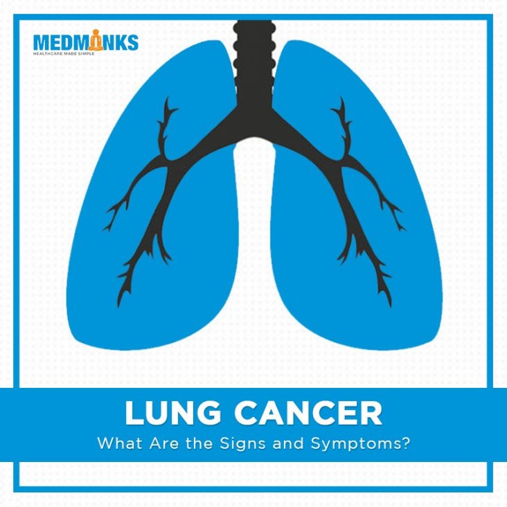 Lungenkrebs-was-sind-die-Anzeichen-und-Symptome