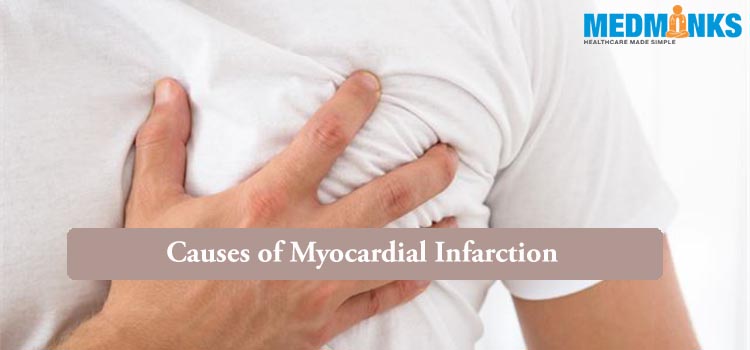 myocardial-infarction-treatment