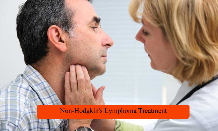 non-hodgkins-lymphoma-treatment