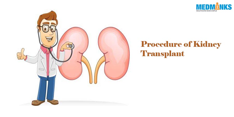 kidney-transplant-procedure-in-india