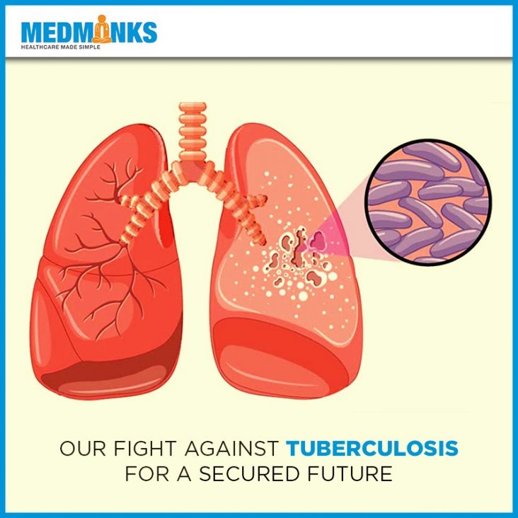dia mundial da tuberculose de 2018-nossa-luta-contra-a-tuberculose-por-um-futuro-garantido