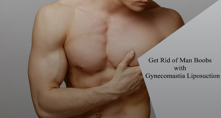 gynecomastia-liposuction-cost