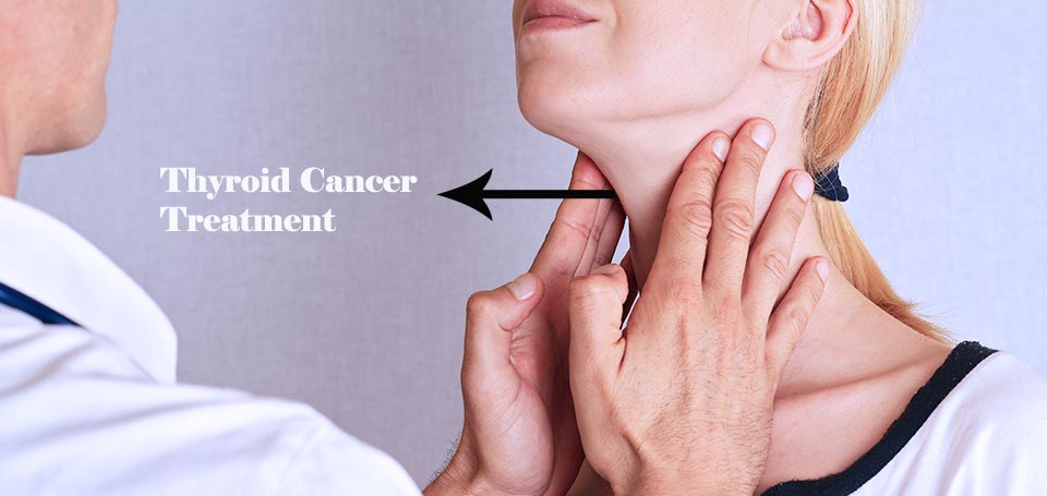 thyroid-cancer-treatment